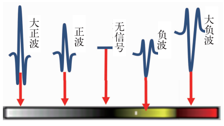 DS9500聲掃設(shè)備著色圖